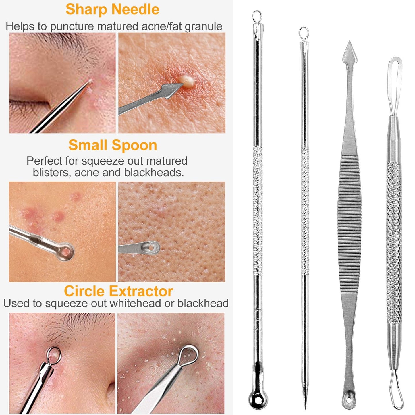 7 Pcs Blackhead Remover Kit Stainless Steel
