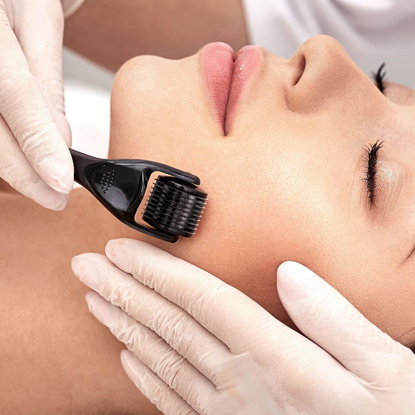 540 Microneedle Hair Growth Improving Derma-roller