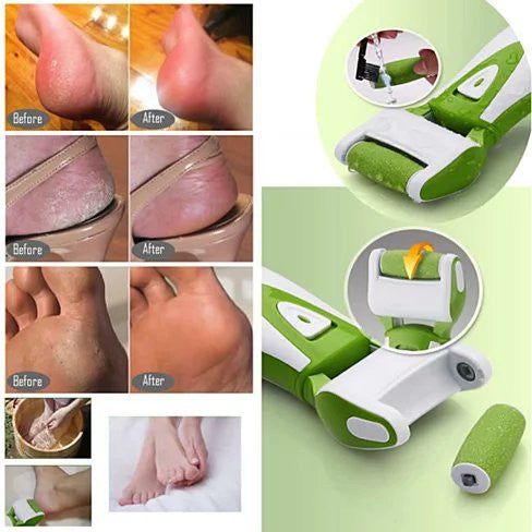 Roll On Sole Foot Spa Wand