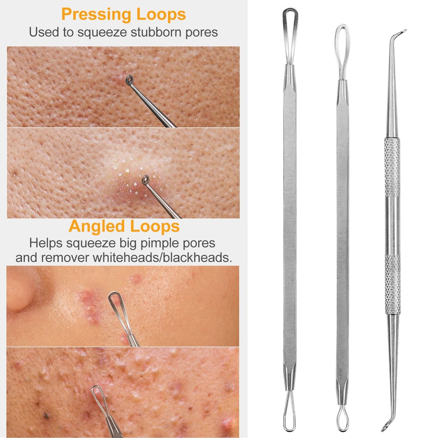 7 Pcs Blackhead Remover Kit Stainless Steel